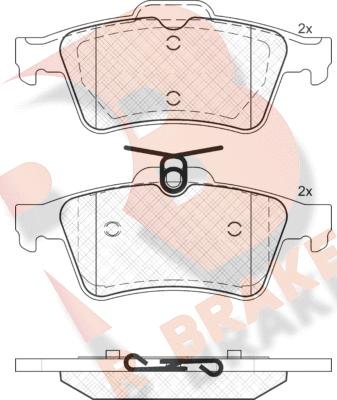 R Brake RB1651 - Bremžu uzliku kompl., Disku bremzes autospares.lv