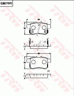 TRW GDB7770 - Bremžu uzliku kompl., Disku bremzes autospares.lv